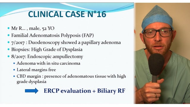 EUS-ENDO 2017